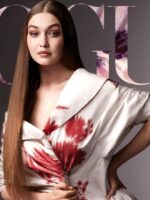 Tampil Dengan Wajah Sembap, Gigi Hadid Lakukan Pembedahan Plastik?